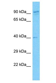 SYCP2L Antibody - SYCP2L antibody Western Blot of 786-0. Antibody dilution: 1 ug/ml.  This image was taken for the unconjugated form of this product. Other forms have not been tested.