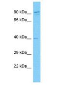 SYCP2L Antibody - SYCP2L antibody Western Blot of 786-0. Antibody dilution: 1 ug/ml.  This image was taken for the unconjugated form of this product. Other forms have not been tested.