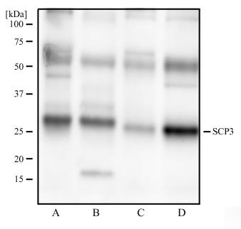 SYCP3 / SCP3 Antibody - Western Blot: SCP3 Antibody (6F9C5) - Western blot analysis of human testis tissue (A), human ovary tissue (B), mouse testis tissue, and mouse ovary tissue (D) using SCP3 antibody at 2 ug/ml.  This image was taken for the unconjugated form of this product. Other forms have not been tested.