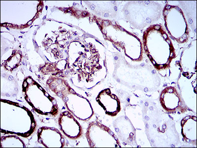 SYCP3 / SCP3 Antibody - IHC of paraffin-embedded kidney tissues using SYCP3 mouse monoclonal antibody with DAB staining.