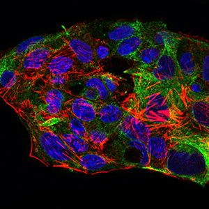 SYCP3 / SCP3 Antibody - Immunofluorescence of HepG2 cells using SYCP3 mouse monoclonal antibody (green). Blue: DRAQ5 fluorescent DNA dye. Red: Actin filaments have been labeled with Alexa Fluor-555 phalloidin.