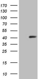 SYCP3 / SCP3 Antibody - HEK293T cells were transfected with the pCMV6-ENTRY control. (Left lane) or pCMV6-ENTRY SYCP3. (Right lane) cDNA for 48 hrs and lysed. Equivalent amounts of cell lysates. (5 ug per lane) were separated by SDS-PAGE and immunoblotted with anti-SYCP3. (1:2000)