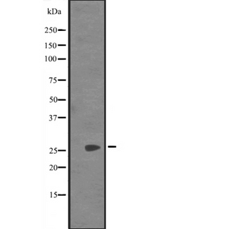 SYCP3 / SCP3 Antibody - Western blot analysis of SYCP3 expression in Jurkat cells lysate. The lane on the left is treated with the antigen-specific peptide.