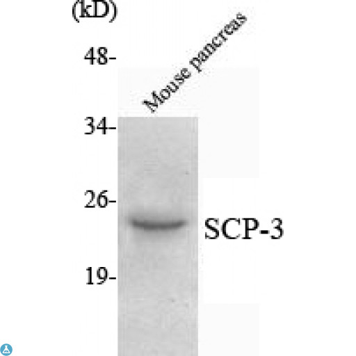 SYCP3 / SCP3 Antibody - Western Blot (WB) analysis using SCP-3 Monoclonal Antibody against mouse pancreas lysate.