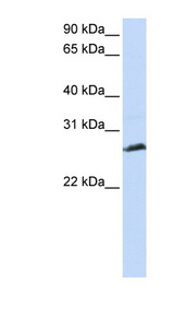 SYCP3 / SCP3 Antibody - SYCP3 antibody Western blot of Jurkat lysate. This image was taken for the unconjugated form of this product. Other forms have not been tested.