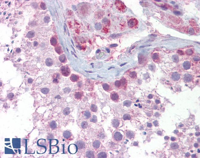 SYCP3 / SCP3 Antibody - Anti-SYCP3 antibody IHC of human testis. Immunohistochemistry of formalin-fixed, paraffin-embedded tissue after heat-induced antigen retrieval. Antibody concentration 5 ug/ml.  This image was taken for the unconjugated form of this product. Other forms have not been tested.