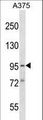 SYDE1 Antibody - SYDE1 Antibody western blot of A375 cell line lysates (35 ug/lane). The SYDE1 antibody detected the SYDE1 protein (arrow).