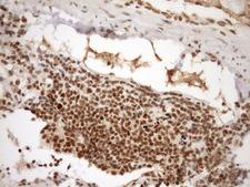 SYF2 / p29 Antibody - Immunohistochemical staining of paraffin-embedded Human Ovary tissue within the normal limits using anti-SYF2 mouse monoclonal antibody. (Heat-induced epitope retrieval by Tris-EDTA, pH8.0)(1:150)