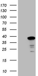 SYF2 / p29 Antibody - HEK293T cells were transfected with the pCMV6-ENTRY control (Left lane) or pCMV6-ENTRY SYF2 (Right lane) cDNA for 48 hrs and lysed. Equivalent amounts of cell lysates (5 ug per lane) were separated by SDS-PAGE and immunoblotted with anti-SYF2 (1:2000).