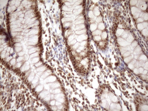 SYF2 / p29 Antibody - IHC of paraffin-embedded Human colon tissue using anti-SYF2 mouse monoclonal antibody. (Heat-induced epitope retrieval by Tris-EDTA, pH8.0)(1:150).