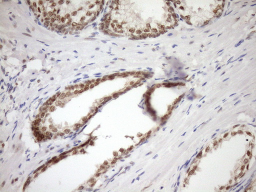 SYF2 / p29 Antibody - IHC of paraffin-embedded Human prostate tissue using anti-SYF2 mouse monoclonal antibody. (Heat-induced epitope retrieval by Tris-EDTA, pH8.0)(1:150).