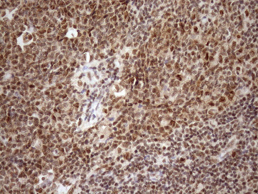 SYF2 / p29 Antibody - IHC of paraffin-embedded Human lymph node tissue using anti-SYF2 mouse monoclonal antibody. (Heat-induced epitope retrieval by Tris-EDTA, pH8.0)(1:150).