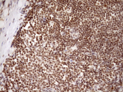 SYF2 / p29 Antibody - IHC of paraffin-embedded Human tonsil using anti-SYF2 mouse monoclonal antibody. (Heat-induced epitope retrieval by Tris-EDTA, pH8.0)(1:150).