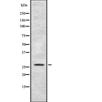 SYF2 / p29 Antibody - Western blot analysis of SYF2 expression in mouse liver tissue lysate. The lane on the left is treated with the antigen-specific peptide.