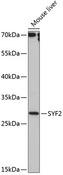 SYF2 / p29 Antibody - Western blot analysis of extracts of mouse liver using SYF2 Polyclonal Antibody at dilution of 1:1000.