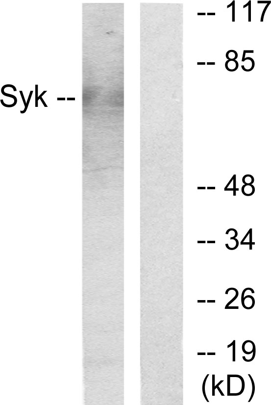 SYK Antibody - Western blot analysis of lysates from HepG2 cells, using SYK Antibody. The lane on the right is blocked with the synthesized peptide.