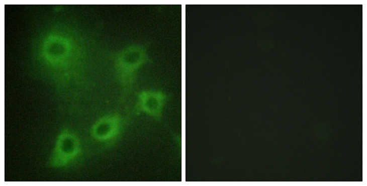 SYK Antibody - Immunofluorescence analysis of COS7 cells, using SYK Antibody. The picture on the right is blocked with the synthesized peptide.