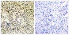 SYK Antibody - Immunohistochemistry analysis of paraffin-embedded human ovary tissue, using SYK Antibody. The picture on the right is blocked with the synthesized peptide.