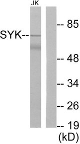 SYK Antibody - Western blot analysis of lysates from Jurkat cells, treated with UV 15', using SYK Antibody. The lane on the right is blocked with the synthesized peptide.