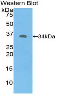 SYK Antibody - Western blot of recombinant SYK.  This image was taken for the unconjugated form of this product. Other forms have not been tested.