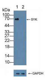 SYK Antibody - Knockout Varification: Lane 1: Wild-type 293T cell lysate; Lane 2: SYK knockout 293T cell lysate; Predicted MW: 69,72kd Observed MW: 69kd Primary Ab: 5µg/ml Rabbit Anti-Human SYK Antibody Second Ab: 0.2µg/mL HRP-Linked Caprine Anti-Rabbit IgG Polyclonal Antibody