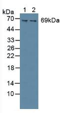 SYK Antibody - Western Blot; Sample: Lane1: Mouse Spleen Tissue; Lane2: Rat Spinal Cord Tissue.