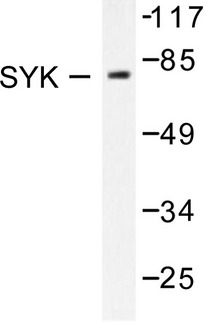 SYK Antibody - Western blot of SYK (L519) pAb in extracts from K562 cells treated UV 15' or COS7 cells treated Heat shock.