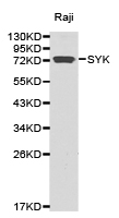 SYK Antibody - Western blot of extracts of Raji cell lines, using SYK antibody.