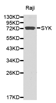 SYK Antibody - Western blot analysis of extracts of Raji cell lines.
