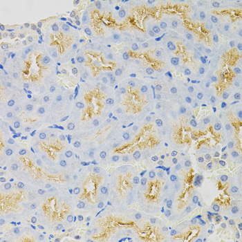 SYK Antibody - Immunohistochemistry of paraffin-embedded rat kidney tissue.