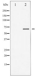 SYK Antibody - Western blot of SYK expression in UV treated K562 whole cell lysates,The lane on the left is treated with the antigen-specific peptide.