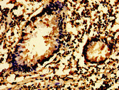 SYK Antibody - Immunohistochemistry image of paraffin-embedded human appendix tissue at a dilution of 1:100