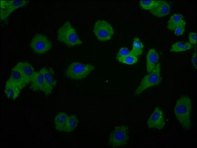 SYK Antibody - Immunofluorescence staining of HepG2 cells with SYK Antibody at 1:166, counter-stained with DAPI. The cells were fixed in 4% formaldehyde, permeabilized using 0.2% Triton X-100 and blocked in 10% normal Goat Serum. The cells were then incubated with the antibody overnight at 4°C. The secondary antibody was Alexa Fluor 488-congugated AffiniPure Goat Anti-Rabbit IgG(H+L).