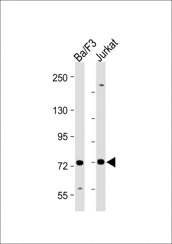 SYK Antibody - All lanes: Anti-Syk (Y525/526) Antibody at 1:2000 dilution Lane 1: Ba/F3 whole cell lysate Lane 2: Jurkat whole cell lysate Lysates/proteins at 20 µg per lane. Secondary Goat Anti-Rabbit IgG, (H+L), Peroxidase conjugated at 1/10000 dilution. Predicted band size: 72 kDa Blocking/Dilution buffer: 5% NFDM/TBST.