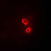 SYK Antibody - Immunofluorescent analysis of SYK staining in COS7  cells. Formalin-fixed cells were permeabilized with 0.1% Triton X-100 in TBS for 5-10 minutes and blocked with 3% BSA-PBS for 30 minutes at room temperature. Cells were probed with the primary antibody in 3% BSA-PBS and incubated overnight at 4 °C in a hidified chamber. Cells were washed with PBST and incubated with Alexa Fluor 647-conjugated secondary antibody (red) in PBS at room temperature in the dark.