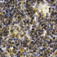SYK Antibody - Immunohistochemical analysis of SYK staining in human spleen formalin fixed paraffin embedded tissue section. The section was pre-treated using heat mediated antigen retrieval with sodium citrate buffer (pH 6.0). The section was then incubated with the antibody at room temperature and detected using an HRP conjugated compact polymer system. DAB was used as the chromogen. The section was then counterstained with haematoxylin and mounted with DPX.