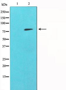 SYK Antibody - Western blot analysis of SYK expression in whole cells lysates. The lane on the left is treated with the antigen-specific peptide.