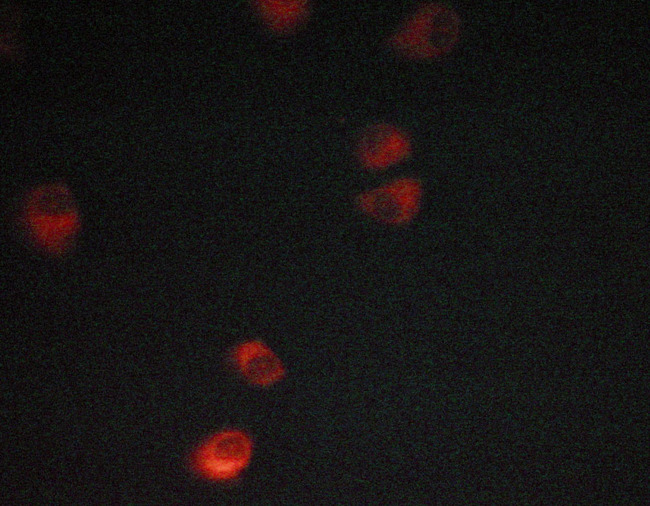SYK Antibody - Staining MCF-7 cells by IF/ICC. The samples were fixed with PFA and permeabilized in 0.1% saponin prior to blocking in 10% serum for 45 min at 37°C. The primary antibody was diluted 1/400 and incubated with the sample for 1 hour at 37°C. A Alexa Fluor® 594 conjugated goat polyclonal to rabbit IgG (H+L), diluted 1/600 was used as secondary antibody.