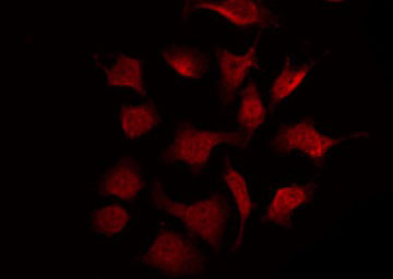 SYK Antibody - Staining COS7 cells by IF/ICC. The samples were fixed with PFA and permeabilized in 0.1% Triton X-100, then blocked in 10% serum for 45 min at 25°C. The primary antibody was diluted at 1:200 and incubated with the sample for 1 hour at 37°C. An Alexa Fluor 594 conjugated goat anti-rabbit IgG (H+L) Ab, diluted at 1/600, was used as the secondary antibody.