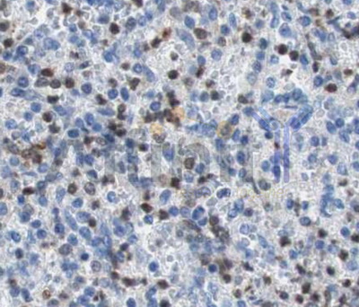 SYK Antibody - 1:100 staining mouse gastric tissue by IHC-P. The tissue was formaldehyde fixed and a heat mediated antigen retrieval step in citrate buffer was performed. The tissue was then blocked and incubated with the antibody for 1.5 hours at 22°C. An HRP conjugated goat anti-rabbit antibody was used as the secondary.