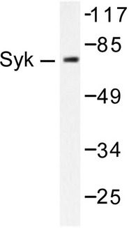 SYK Antibody - Western blot of SYK (F169) pAb in extracts from HepG2 cells.