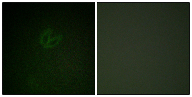 SYK Antibody - Immunofluorescence analysis of HepG2 cells, using SYK (Phospho-Tyr323) Antibody. The picture on the right is blocked with the phospho peptide.