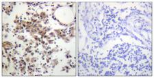 SYK Antibody - Immunohistochemistry analysis of paraffin-embedded human lymph node, using SYK (Phospho-Tyr323) Antibody. The picture on the right is blocked with the phospho peptide.