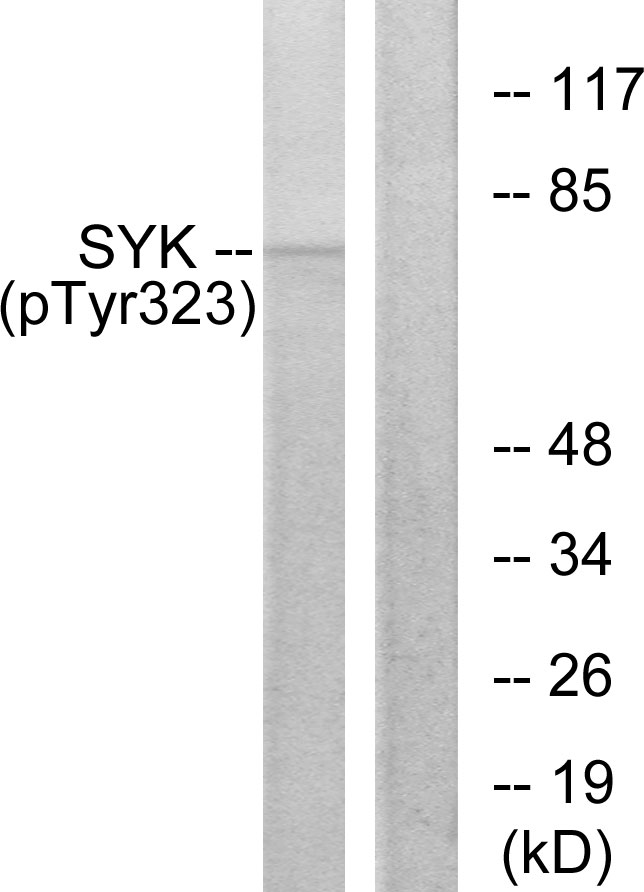 SYK Antibody - Western blot analysis of lysates from HT29 cells, using SYK (Phospho-Tyr323) Antibody. The lane on the right is blocked with the phospho peptide.