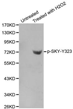 SYK Antibody - Western blot analysis of extracts from Jurkat cells.