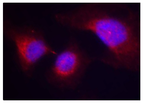 SYK Antibody - Immunofluorescence staining of methanol-fixed Hela cells.