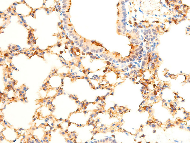 SYK Antibody - 1:100 staining mouse lung tissue by IHC-P. The tissue was formaldehyde fixed and a heat mediated antigen retrieval step in citrate buffer was performed. The tissue was then blocked and incubated with the antibody for 1.5 hours at 22°C. An HRP conjugated goat anti-rabbit antibody was used as the secondary.