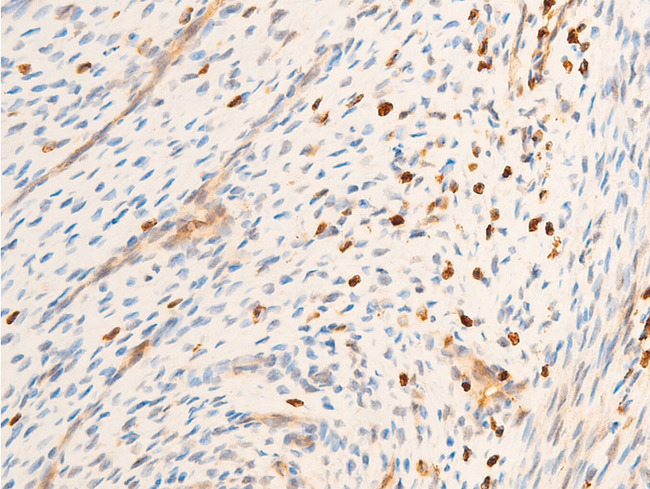 SYK Antibody - 1:100 staining rat uterine tissue by IHC-P. The tissue was formaldehyde fixed and a heat mediated antigen retrieval step in citrate buffer was performed. The tissue was then blocked and incubated with the antibody for 1.5 hours at 22°C. An HRP conjugated goat anti-rabbit antibody was used as the secondary.
