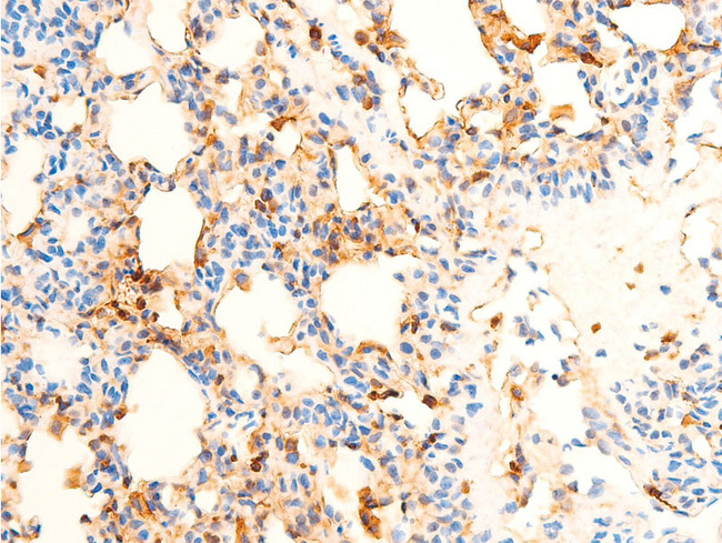 SYK Antibody - 1:100 staining rat lung tissue by IHC-P. The tissue was formaldehyde fixed and a heat mediated antigen retrieval step in citrate buffer was performed. The tissue was then blocked and incubated with the antibody for 1.5 hours at 22°C. An HRP conjugated goat anti-rabbit antibody was used as the secondary.