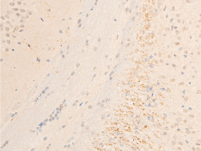 SYK Antibody - 1:100 staining mouse brain tissue by IHC-P. The tissue was formaldehyde fixed and a heat mediated antigen retrieval step in citrate buffer was performed. The tissue was then blocked and incubated with the antibody for 1.5 hours at 22°C. An HRP conjugated goat anti-rabbit antibody was used as the secondary.